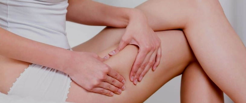 appearance of cellulite